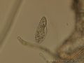 Paramecium sp.